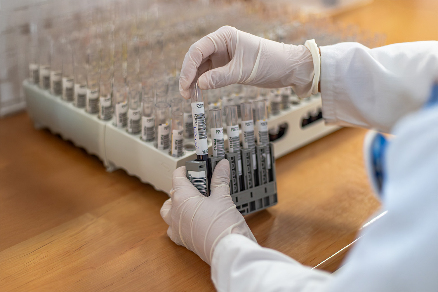 Estudo das hormonas e papel na regulação do organismo, auxiliando no diagnóstico de distúrbios endócrinos.